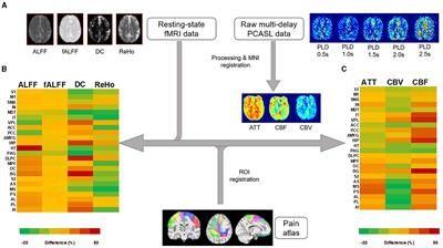 Multimodal functional imaging and clinical correlates of pain regions in chronic low-back pain patients treated with spinal cord stimulation: a pilot study